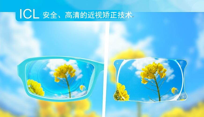 超高度近视矫正ICL 超高度近视矫正ICL