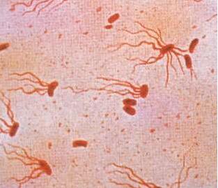 natmicrobiol:科学家阐明伤寒沙门菌诱发人类疾病的新型分子机制