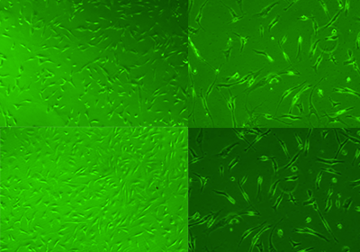 Cell Culture Experiment: Study of Collagen Type I & Collagen Type II on Chondrocytes