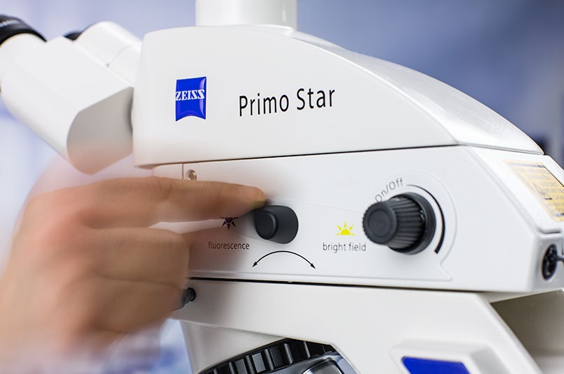 Primo Star iLED 灵活的肺结核检测综合解决方案