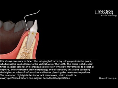 34 Quality closeup _V02 