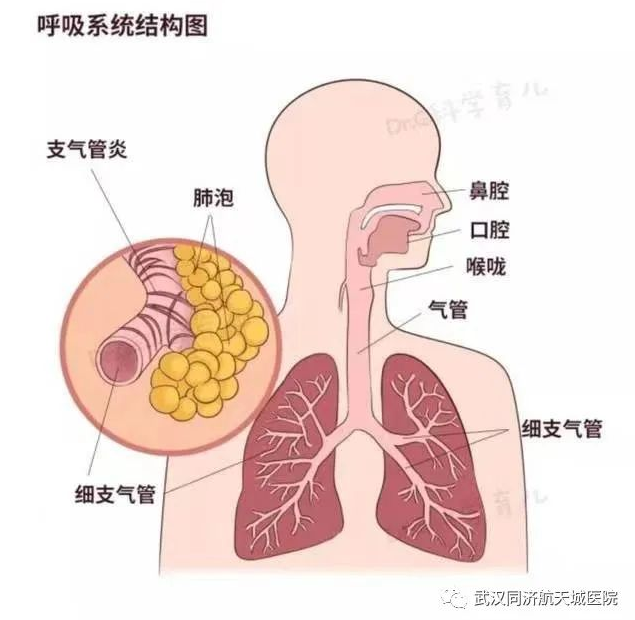 小儿急性支气管炎的预防