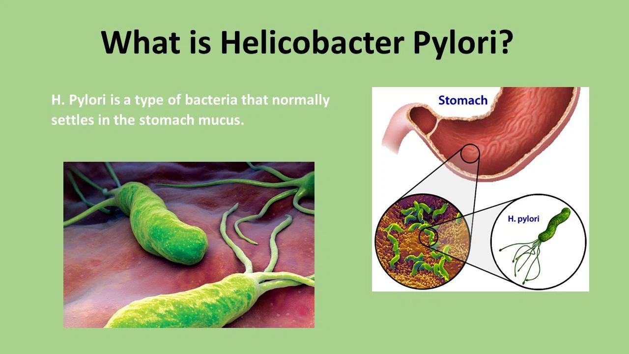 13c Ubt Rapid Test Analyzer Supplier For H.pylori Infection Diagnosis