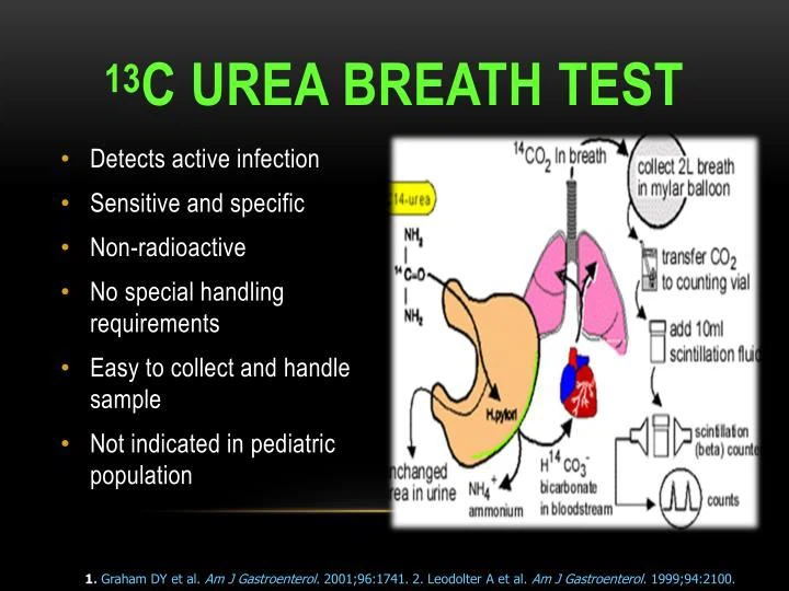 13c Ubt Rapid Test Analyzer Supplier For H.pylori Infection Diagnosis