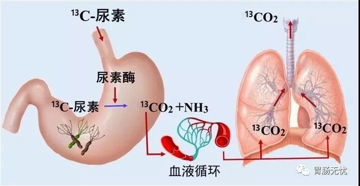 13c Ubt Kit For H.pylori Infection Diagnosis