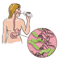 13C Urea Breath Test Kit For H. Pylori Diagnosis (75mg)