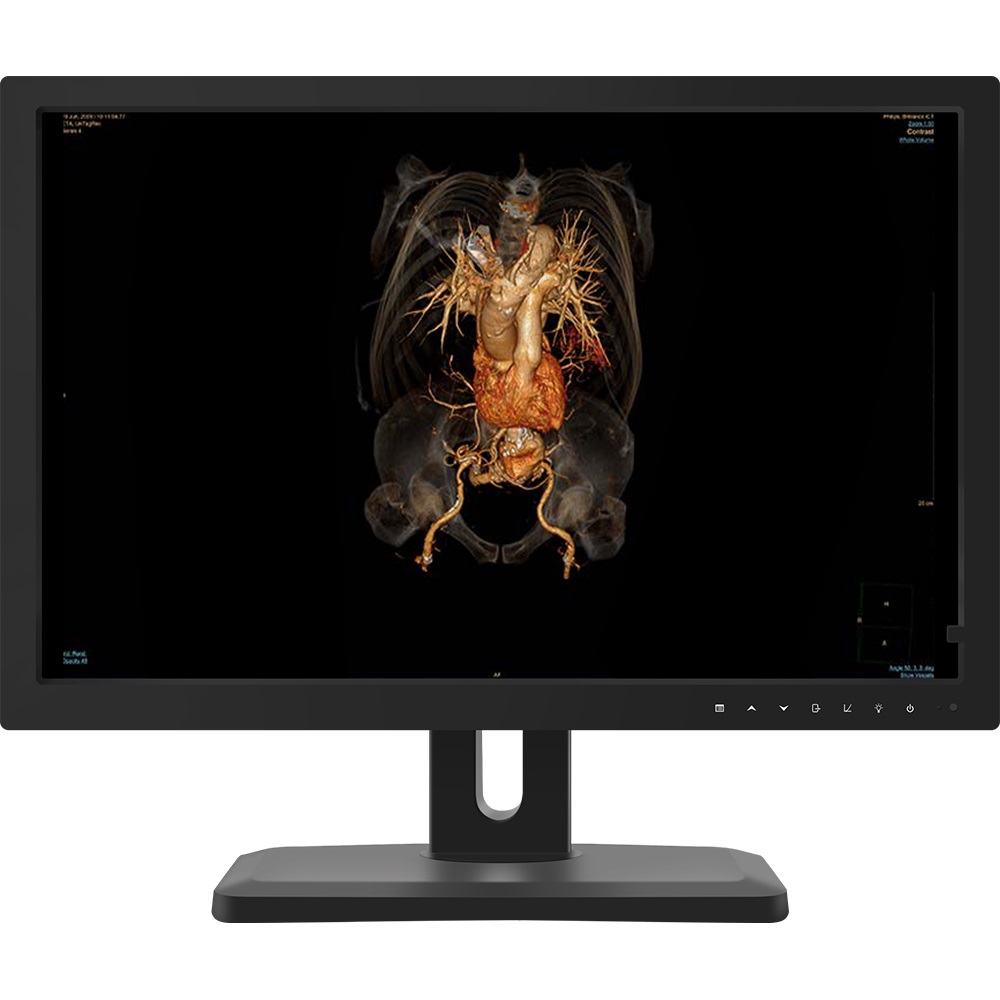HS 24X20 24英寸