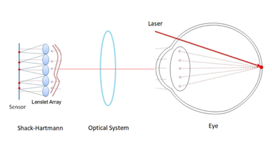 用于眼睛像差评估的Shack‑Hartmann传感器建模