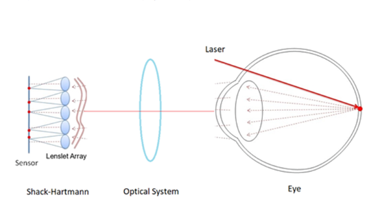 用于眼睛像差评估的Shack‑Hartmann传感器建模